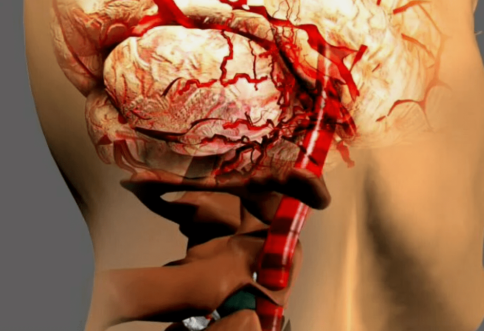 than cervical osteochondrose is dangerous